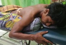 Kondisi korban Rangga Eriansyah (Yoga)terlihat terbentang di Puskesmas Sanggar. (Fen/Ist)